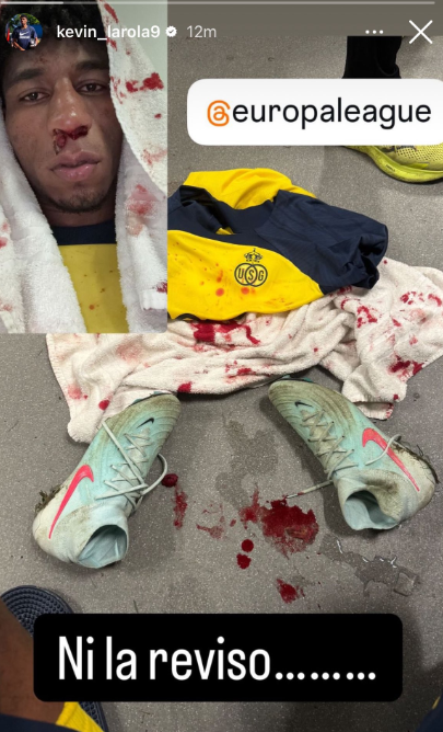 VIDEO |⚽️🔥 Polémica y un penal no cobrado. Kevin Rodríguez sufrió un golpe brutal en el área ante Ajax