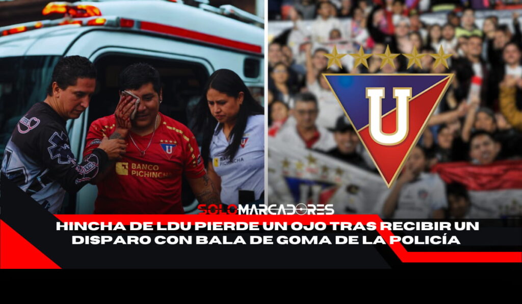 hincha de Liga de Quito pierde un ojo tras enfrentamiento con la Policía