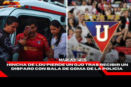 hincha de Liga de Quito pierde un ojo tras enfrentamiento con la Policía