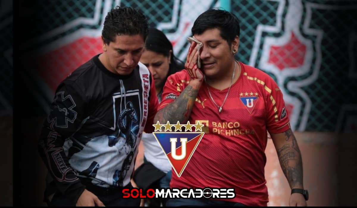Hincha de Liga pierde un ojo