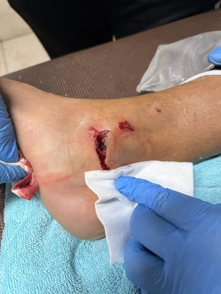 Impactante herida de Luis Fernando León